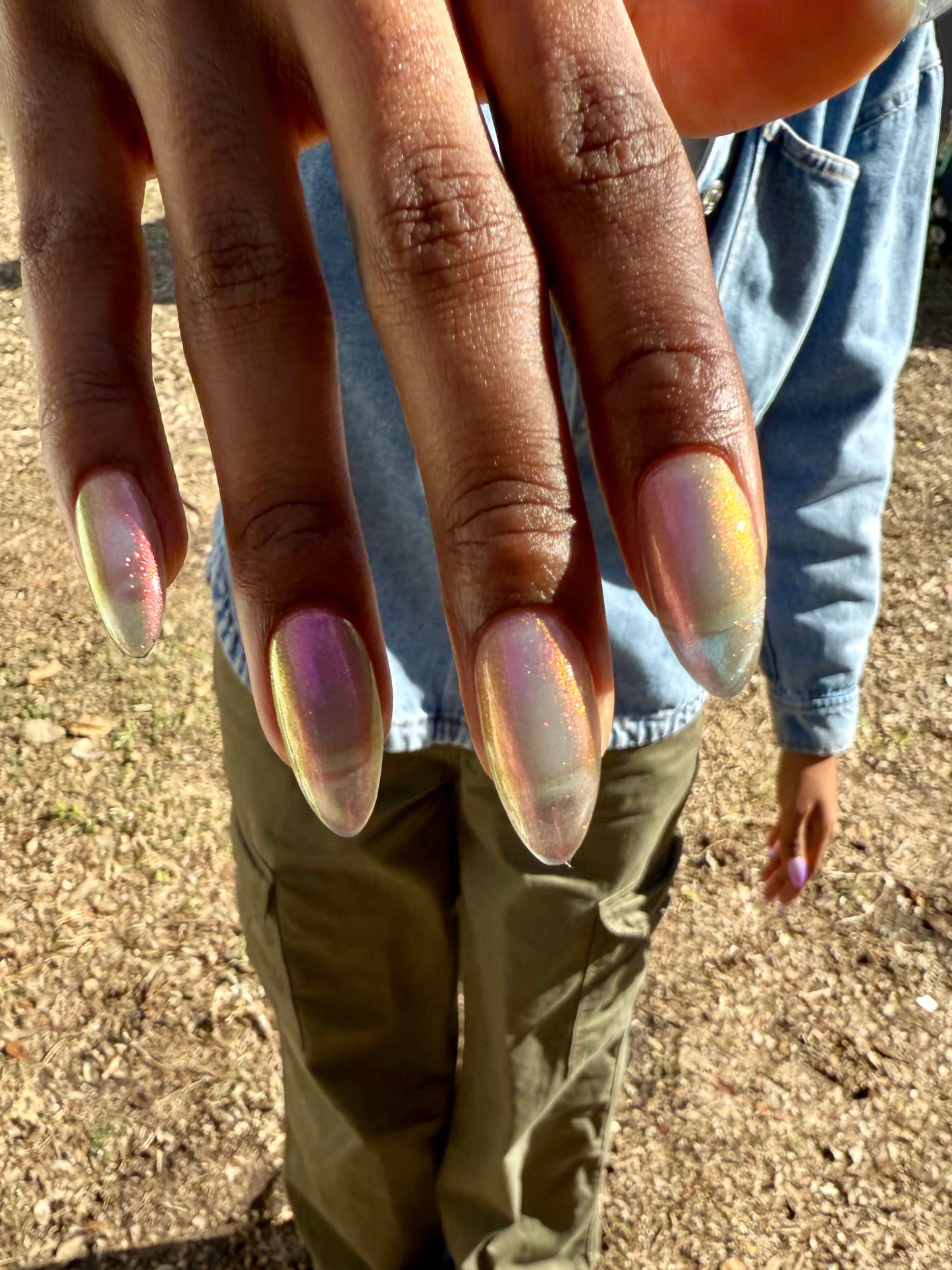 JUSTICE FOR RECEDING HAIRLINES! THE PERPETUAL SCAPEGOAT OF BAD PERSONALITIES BEING DUMPED