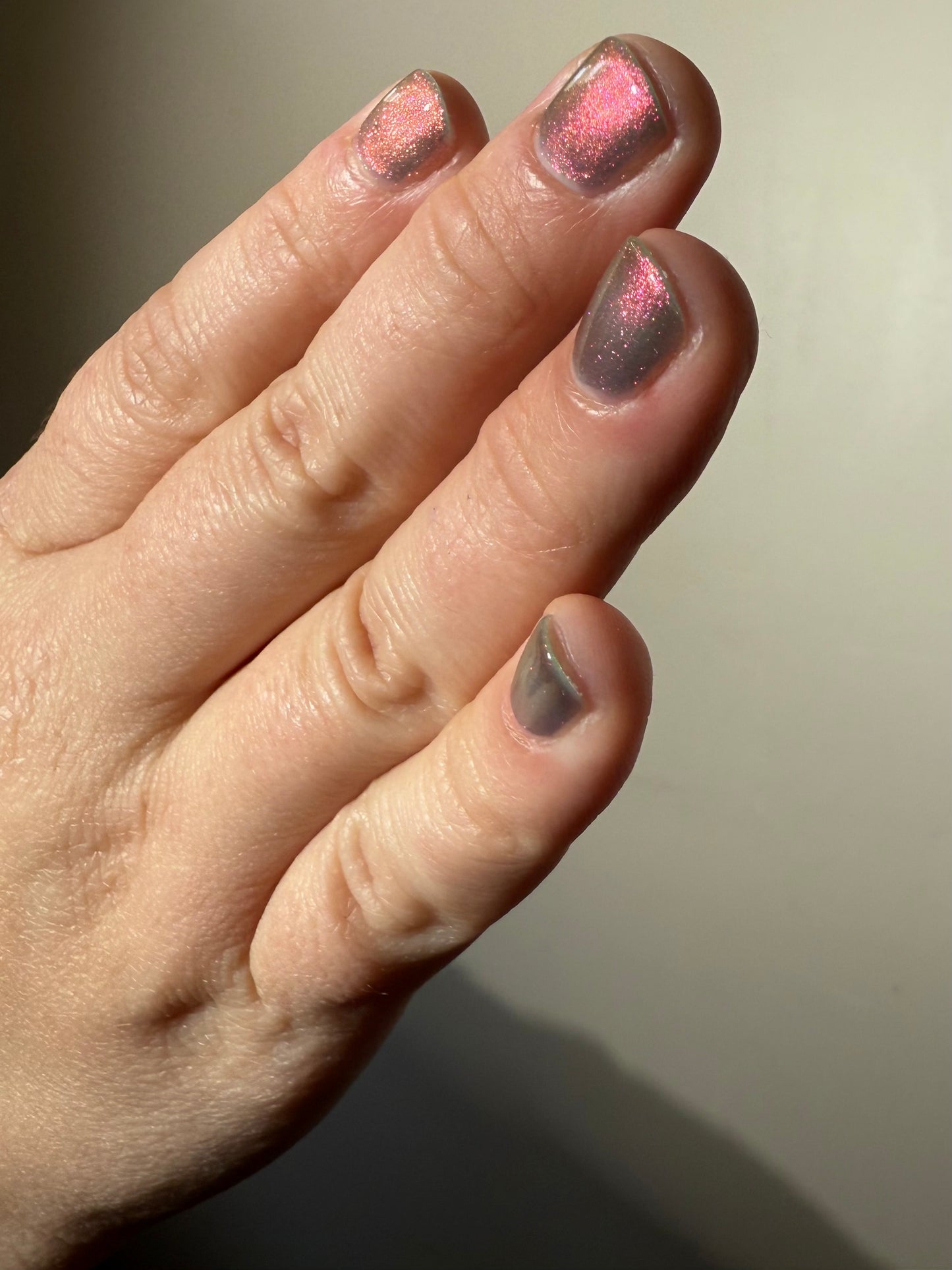 JUSTICE FOR RECEDING HAIRLINES! THE PERPETUAL SCAPEGOAT OF BAD PERSONALITIES BEING DUMPED