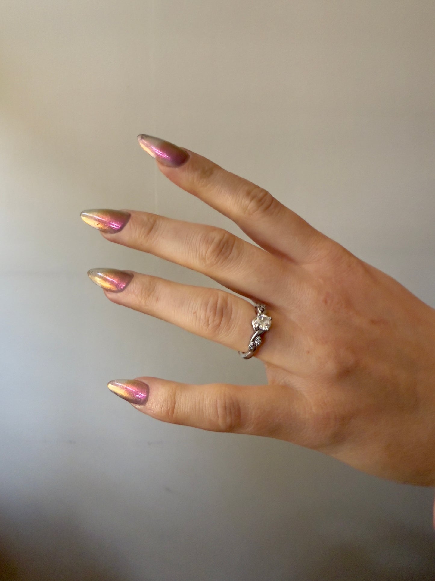 JUSTICE FOR RECEDING HAIRLINES! THE PERPETUAL SCAPEGOAT OF BAD PERSONALITIES BEING DUMPED