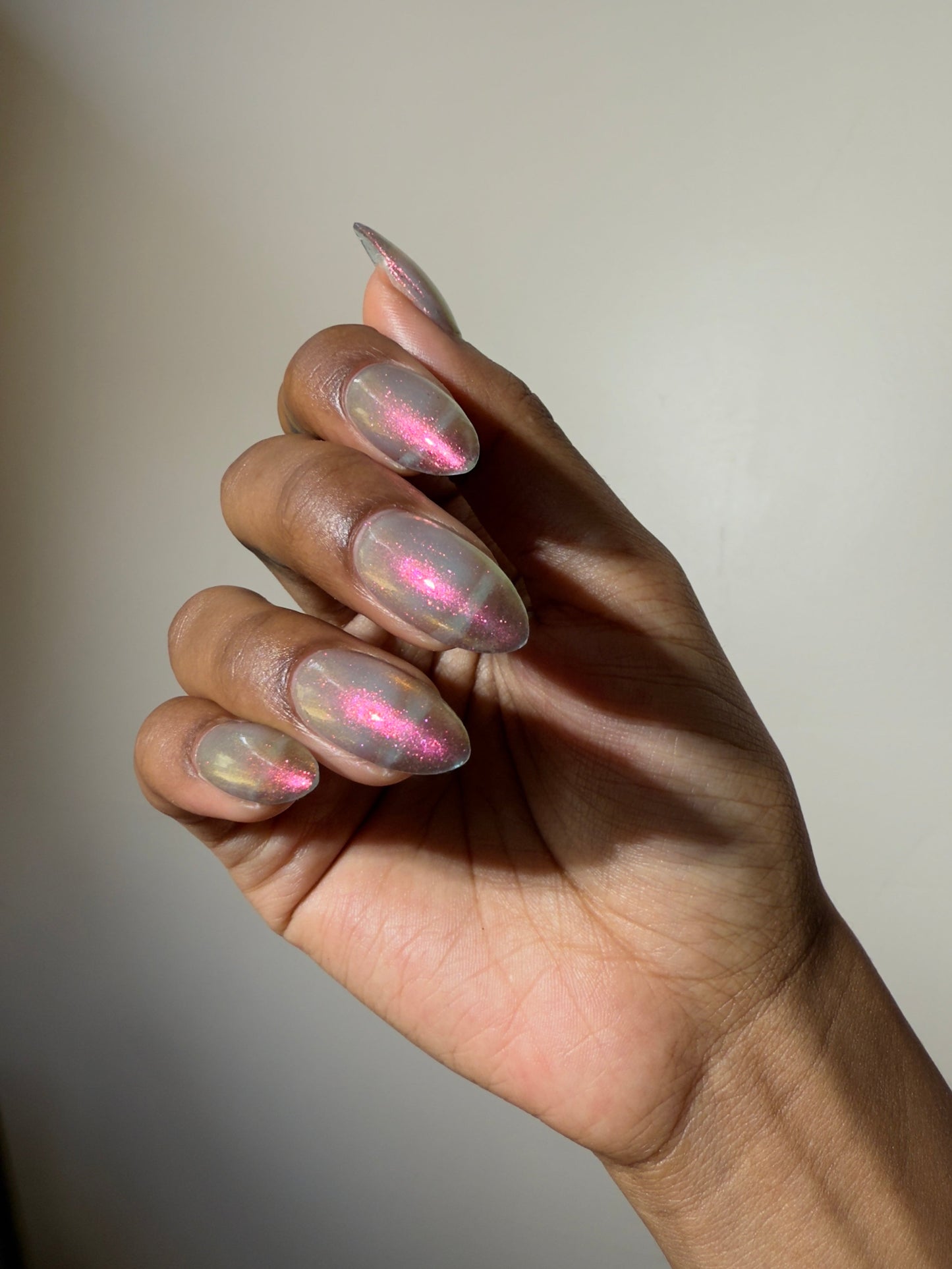 JUSTICE FOR RECEDING HAIRLINES! THE PERPETUAL SCAPEGOAT OF BAD PERSONALITIES BEING DUMPED