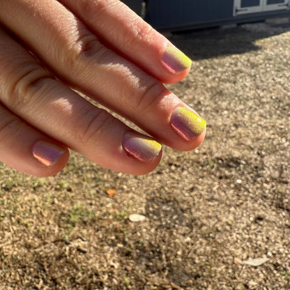 JUSTICE FOR RECEDING HAIRLINES! THE PERPETUAL SCAPEGOAT OF BAD PERSONALITIES BEING DUMPED