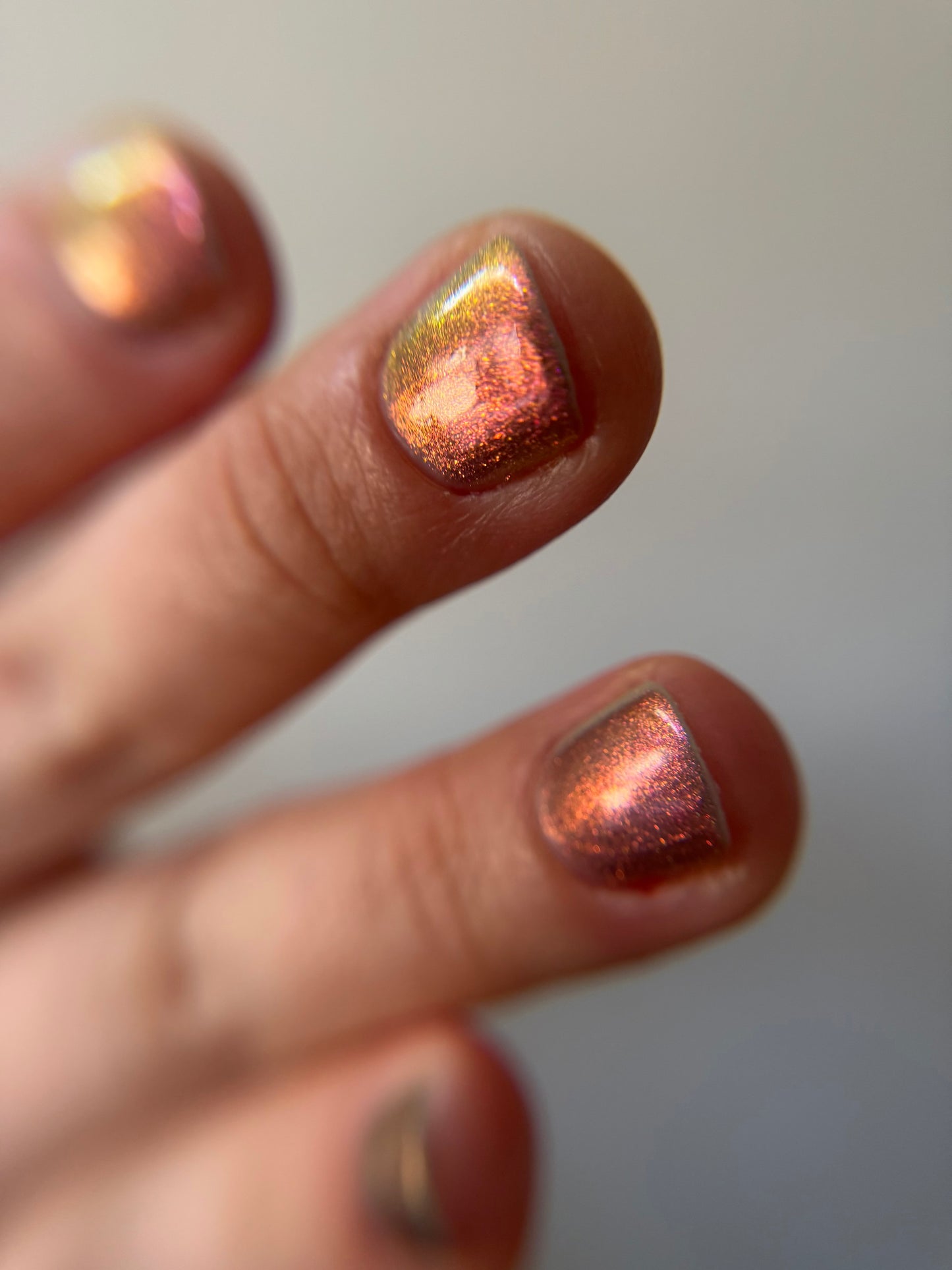 JUSTICE FOR RECEDING HAIRLINES! THE PERPETUAL SCAPEGOAT OF BAD PERSONALITIES BEING DUMPED