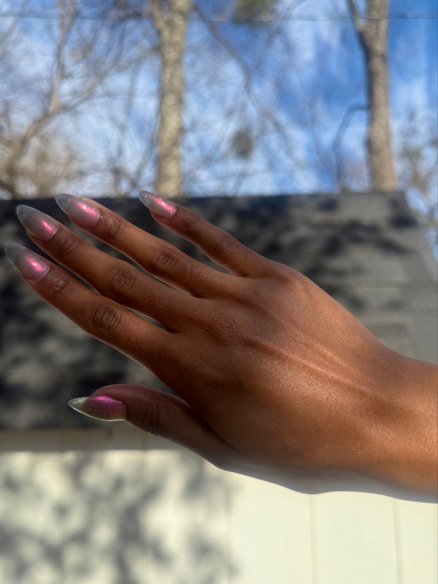 JUSTICE FOR RECEDING HAIRLINES! THE PERPETUAL SCAPEGOAT OF BAD PERSONALITIES BEING DUMPED