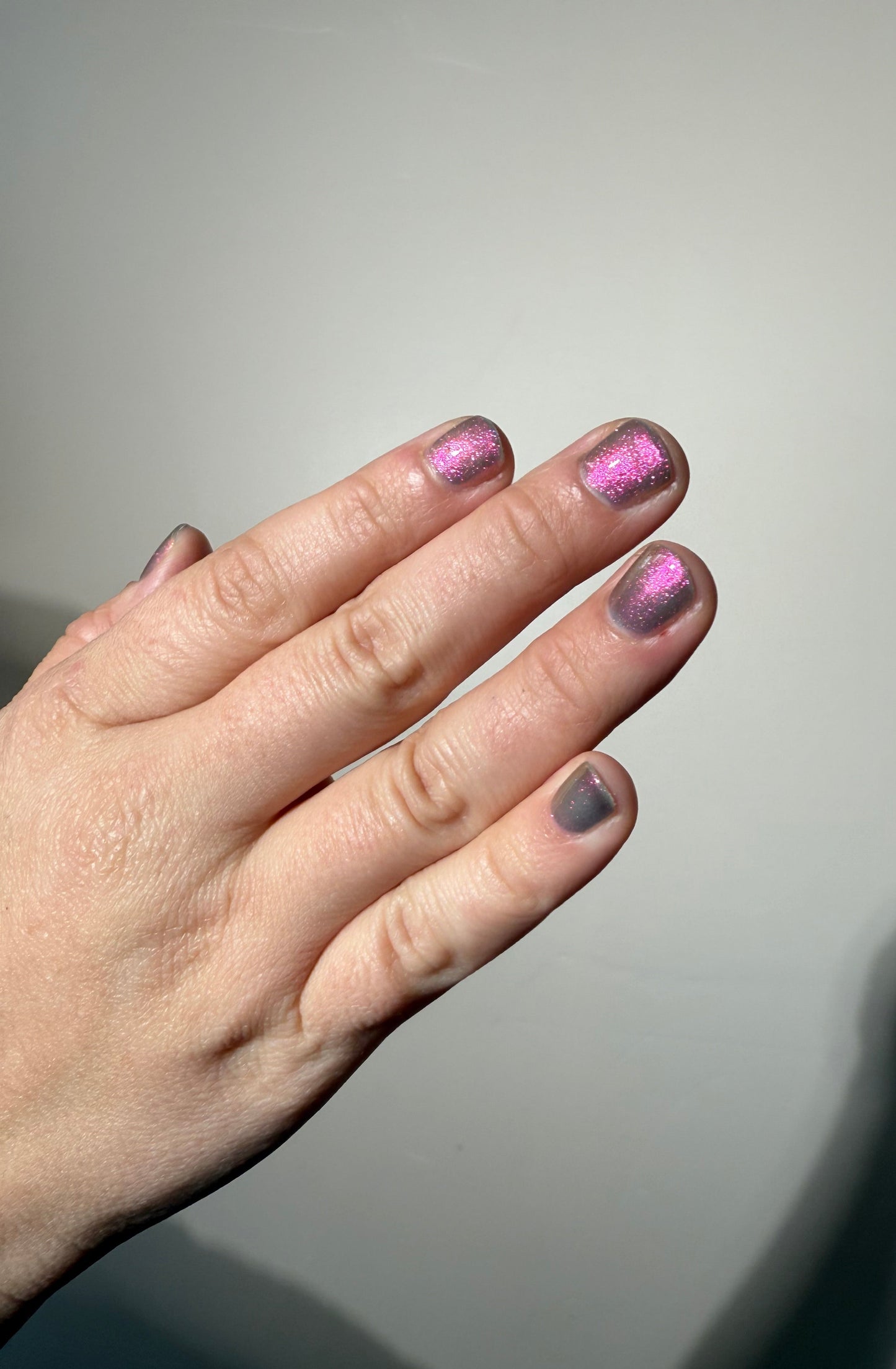 JUSTICE FOR RECEDING HAIRLINES! THE PERPETUAL SCAPEGOAT OF BAD PERSONALITIES BEING DUMPED