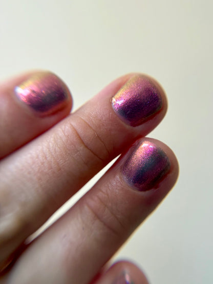 JUSTICE FOR RECEDING HAIRLINES! THE PERPETUAL SCAPEGOAT OF BAD PERSONALITIES BEING DUMPED