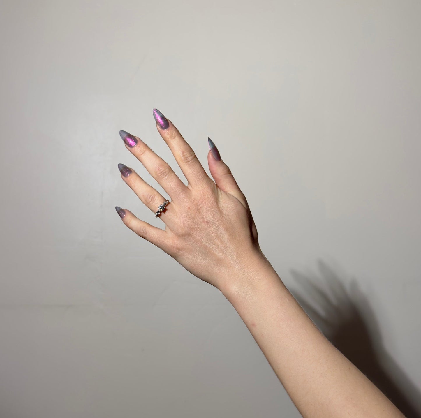 JUSTICE FOR RECEDING HAIRLINES! THE PERPETUAL SCAPEGOAT OF BAD PERSONALITIES BEING DUMPED